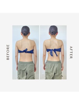 ルーチェビューティープラス(LUCE' beauty +)/肩甲骨剥がし