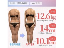 アフリオーラ はなみずき店(affriolant)/ビフォーアフター
