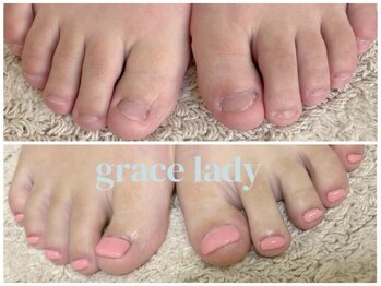 グレースレディ 神戸北店/