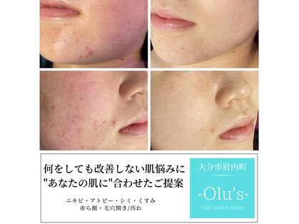 オルズ(Olu's)の写真