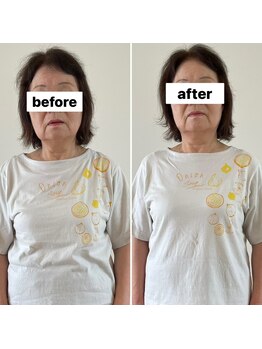 コパン ペティット(Copin Petit)/小顔整顔