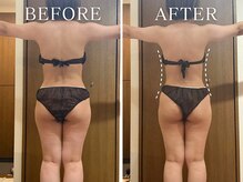 ヨサパーク ニコナ 三軒茶屋南口(YOSA PARK nicona)/座っているだけで燃焼！