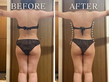 ヨサパーク ニコナ 三軒茶屋南口(YOSA PARK nicona)/座っているだけで燃焼！