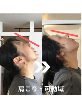 からだサロン サニー 堺東(SUNNY)/首こり・ストレートネック