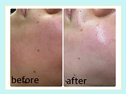 エクラニーク(Eclanique)の写真