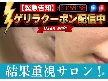 スリリアン 銀座の写真