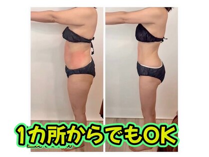 エステルーム パチュリーの写真