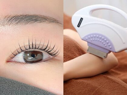 クロエ(Chloe)の写真