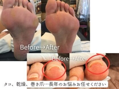 ネイルアンドフットケアサロン エス(S)の写真