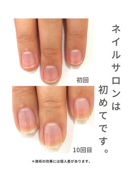 最強ネイルケア