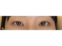 アールエム(Rm)/6月◇まつげ