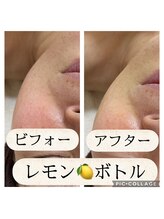 ファブール/レモンボトル