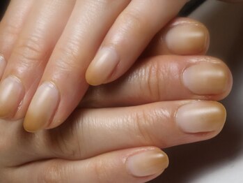 クロ(KURO)/ラテネイル/柳津ネイルサロン