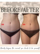 エイエービジュー(Aa.bijou)/