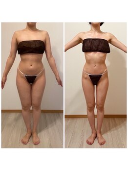 パピヨン(Papillon)/筋肉残しいならい脂肪を落とす◎