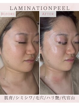 ルリエベル(Relier Belle)/ラミネーションピール