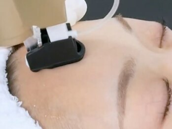 アマランサス(Amaranthus)の写真/【最近話題の”レモンボトル”】引き締めケアで落ちにくい顎下にアプローチ！痛み、ダウンタイムほぼなし♪