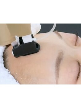 小顔になりたい