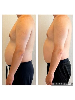 ソニコ 方南町本店(SONICO)/1週間でもこの結果!