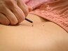 《学割・小学生限定》痛みの少ない経絡鍼灸60分 ¥2000※痛みが少ない鍼を使用