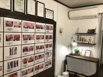 メンズ ユシュレ(Men's YUSYURE)/ビフォーアフター写真多数有り