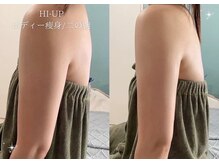 ベル 大和(Belle)/HI-UP｜ボディー痩身