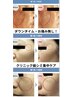 【新導入】徹底集中◎シミケア・フェイシャル定価16,500円→11,000円