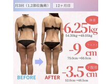 アフリオーラ はなみずき店(affriolant)/ビフォーアフター