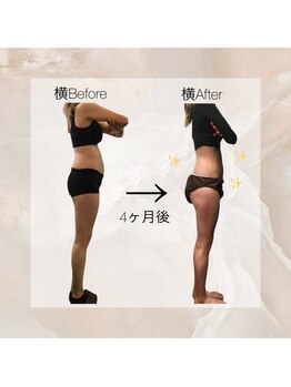 ユメカ 日の出院(YUMEKA)/産後のお客様。4ヶ月後★横