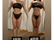 アヌヘア(Anuhea)の雰囲気（痩身技術にも自信あり！他店とは違う全身全霊の技術を是非！！）