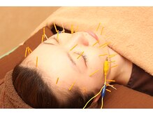 さくら鍼灸整骨院/美容鍼/毛穴/小顔/子連れOK