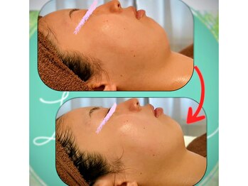 ラ ペルル/ビフォーアフター