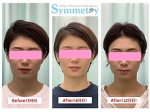 シンメトリー 池袋店/