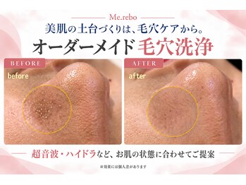 ミレボ(Me.rebo)の写真/夏の紫外線ダメージに！話題のPDRNで乾燥・ハリ不足or高濃度ビタミンCで毛穴・皮脂♪あなたはどっち派？