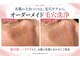 ミレボ(Me.rebo)の写真/夏の紫外線ダメージに！話題のPDRNで乾燥・ハリ不足or高濃度ビタミンCで毛穴・皮脂♪あなたはどっち派？