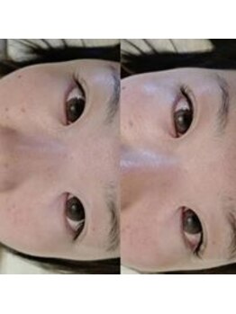 ミミー(MiMe)/アップワードラッシュ