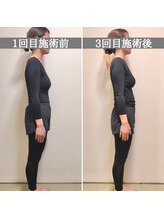 シェア 人形町店(Chare)/【小顔・骨盤矯正・О脚・整体】
