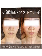 ツルル 岡崎店(TSURURU)/【小顔ソフトコルギ】