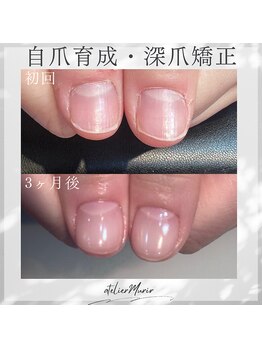 アトリエ ミュリー 代官山(atelier murir)/自爪育成・深爪矯正・巻き爪ケア