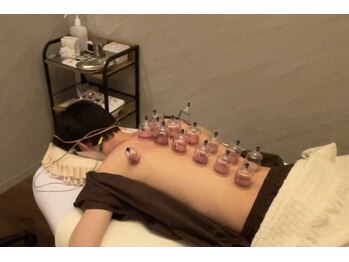 デルタエヌピー63+(δnp63+)/カッピング【小顔/薬院/福岡】