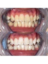 ライトビューティー 池袋店(LightBeauty)/症例写真