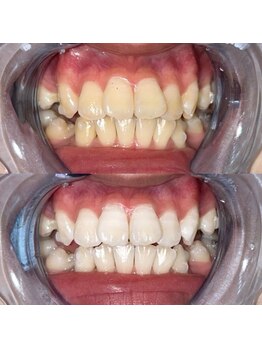 ライトビューティー 池袋店(LightBeauty)/症例写真