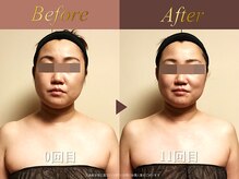 オーシャン(Ocean)/徹底改善コース/週2回×10回