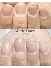 マリーロール 天王寺店(Marie Laure)/自爪育成/深爪矯正/ネイルケア