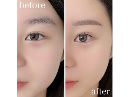 エハコ(ehako)の写真