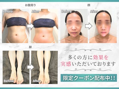 イデアルボーテの写真