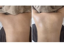 ルリエベル(Relier Belle)/BODYハーブ★箇所相談可♪