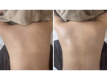 ルリエベル(Relier Belle)/BODYハーブ★箇所相談可♪