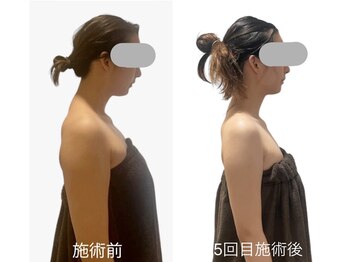 サピュイエ(S'appuyer)/猫背・姿勢改善