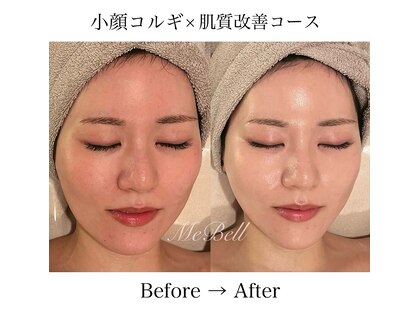 ミベル(MeBell)の写真